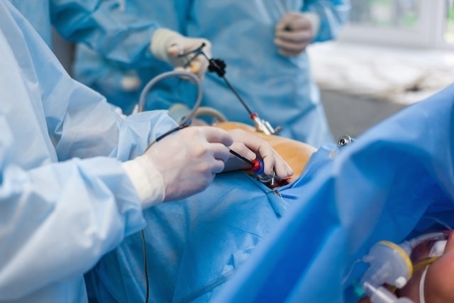 Clinical Experience in Uterine Myomas